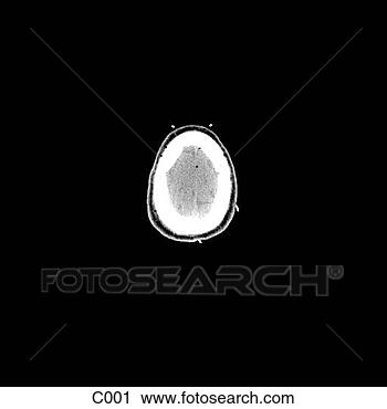Klipart - head, neck. fotosearch 
- klipart İlüstrasyon, 
çizimler ve görüntüler 
ara