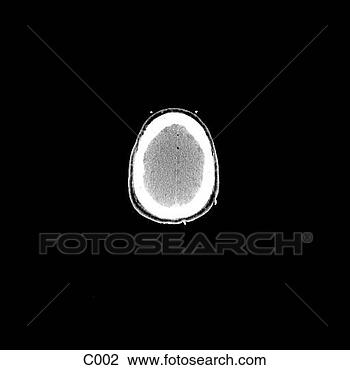 Klip Art - head, neck. fotosearch 
- klipart İlüstrasyon, 
çizimler ve görüntüler 
ara