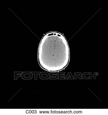 Çizim - head, neck. fotosearch 
- klipart İlüstrasyon, 
çizimler ve görüntüler 
ara