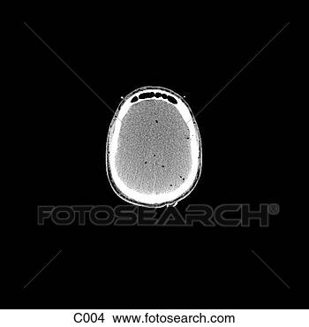Hazır İlüstrasyonlar - head, neck. fotosearch 
- klipart İlüstrasyon, 
çizimler ve görüntüler 
ara