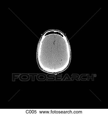 Hazır İlüstrasyonlar - head, neck. fotosearch 
- klipart İlüstrasyon, 
çizimler ve görüntüler 
ara