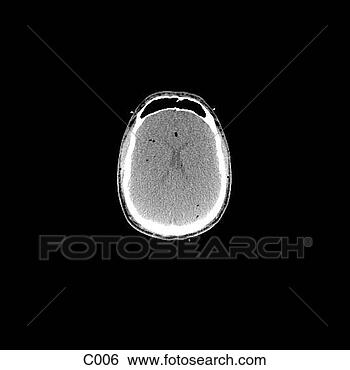 Hazır İlüstrasyonlar - head, neck. fotosearch 
- klipart İlüstrasyon, 
çizimler ve görüntüler 
ara