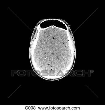 Hazır İlüstrasyonlar - head, neck. fotosearch 
- klipart İlüstrasyon, 
çizimler ve görüntüler 
ara