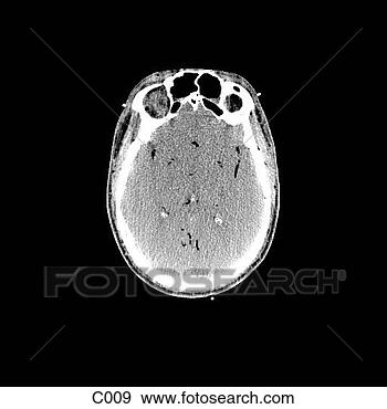 Hazır İlüstrasyonlar - head, neck. fotosearch 
- klipart İlüstrasyon, 
çizimler ve görüntüler 
ara