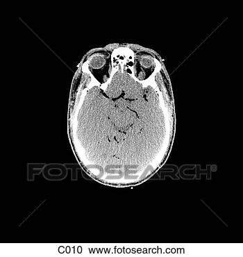 Hazır İlüstrasyonlar - head, neck. fotosearch 
- klipart İlüstrasyon, 
çizimler ve görüntüler 
ara