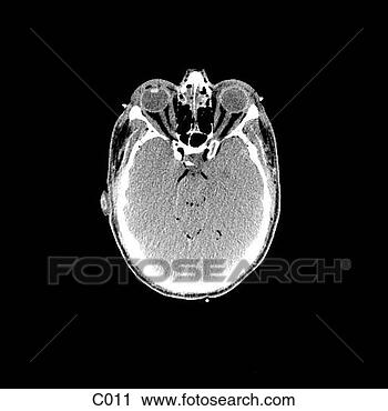 Klipart - head, neck. fotosearch 
- klipart İlüstrasyon, 
çizimler ve görüntüler 
ara
