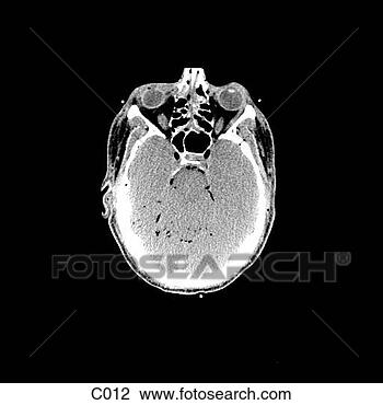 Klip Art - head, neck. fotosearch 
- klipart İlüstrasyon, 
çizimler ve görüntüler 
ara