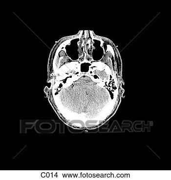 Hazır İlüstrasyonlar - head, neck. fotosearch 
- klipart İlüstrasyon, 
çizimler ve görüntüler 
ara