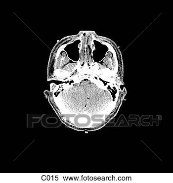 Hazır İlüstrasyonlar - head, neck. fotosearch 
- klipart İlüstrasyon, 
çizimler ve görüntüler 
ara
