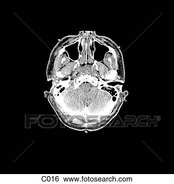 Hazır İlüstrasyonlar - head, neck. fotosearch 
- klipart İlüstrasyon, 
çizimler ve görüntüler 
ara
