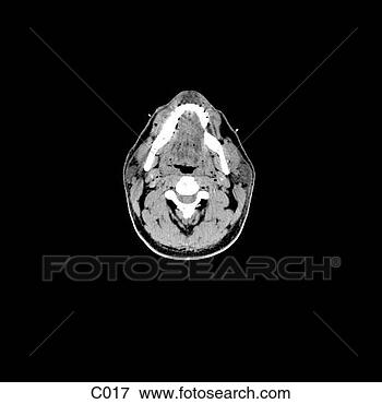 Hazır İlüstrasyonlar - head, neck. fotosearch 
- klipart İlüstrasyon, 
çizimler ve görüntüler 
ara