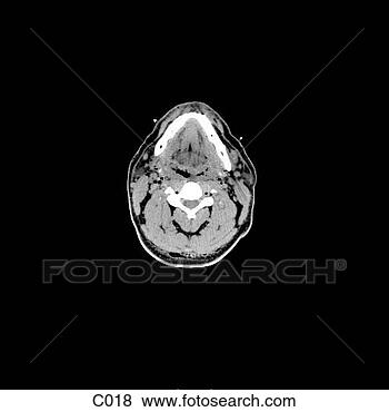 Hazır İlüstrasyonlar - head, neck. fotosearch 
- klipart İlüstrasyon, 
çizimler ve görüntüler 
ara