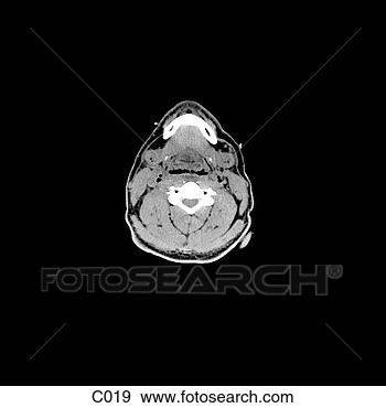Hazır İlüstrasyonlar - head, neck. fotosearch 
- klipart İlüstrasyon, 
çizimler ve görüntüler 
ara