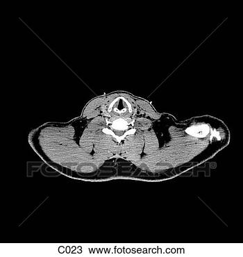 Çizim - thorax. fotosearch 
- klipart İlüstrasyon, 
çizimler ve görüntüler 
ara
