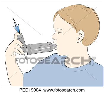 Stock Illustration - illustration of 
boy demonstrating 
proper use of 
metered dose inhaler. 
fotosearch - search 
clipart, illustration, 
drawings and vector 
eps graphics images