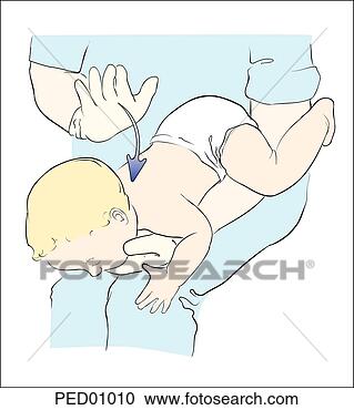 Stock Illustration - illustration demonstrating 
proper administration 
of back blows 
to. fotosearch 
- search clipart, 
illustration, 
drawings and vector 
eps graphics images