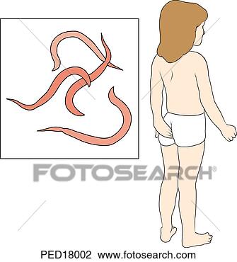 Clip Art - main image shows 
young child scratch 
the anal region, 
 an indication. 
fotosearch - search 
clipart, illustration, 
drawings and vector 
eps graphics images