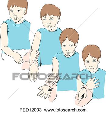 radial head subluxation reduction