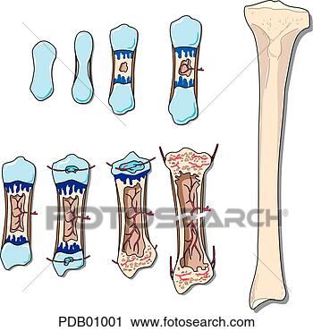 Clipart - schematic showing 
stages of bone 
development. fotosearch 
- search clipart, 
illustration, 
drawings and vector 
eps graphics images