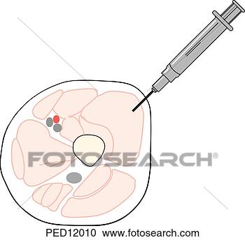 intramuscular injection sites impression