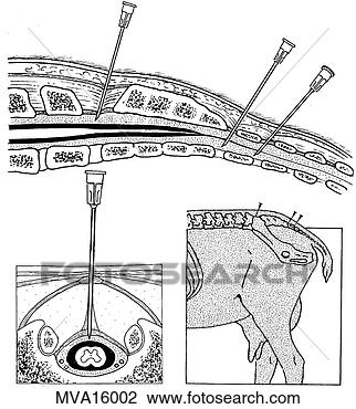 epidural-analges-bovine_~MVA16002.jpg