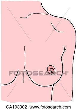 Clip Art - breast, left. 
fotosearch - search 
clipart, illustration, 
drawings and vector 
eps graphics images