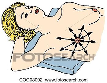 Clip Art - breast palpation 
technique. fotosearch 
- search clipart, 
illustration, 
drawings and vector 
eps graphics images