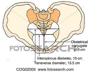 Arquivos de Ilustração - pélvico,  diameters. 
fotosearch - busca 
de ilustrações 
clipeart e desenhos