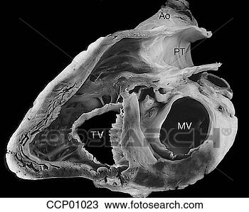 Drawing - cardiac valves, 
atrioventricular. 
fotosearch - search 
clipart, illustration, 
drawings and vector 
eps graphics images