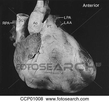 Arquivos de Ilustrações - cardíaco,  anatomia, 
 externo. fotosearch 
- busca de ilustrações 
clipeart e desenhos