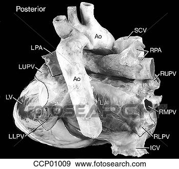Arquivos de Ilustrações - cardíaco,  anatomia, 
 externo. fotosearch 
- busca de ilustrações 
clipeart e desenhos