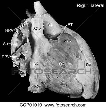 Arquivos de Ilustração - cardíaco,  anatomia, 
 externo. fotosearch 
- busca de ilustrações 
clipeart e desenhos