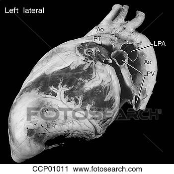 Clipart - cardíaco,  anatomia, 
 externo. fotosearch 
- busca de ilustrações 
clipeart e desenhos