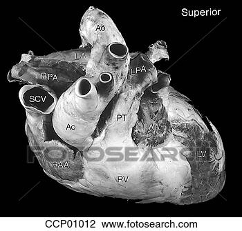 Clip Art - cardíaco,  anatomia, 
 externo. fotosearch 
- busca de ilustrações 
clipeart e desenhos