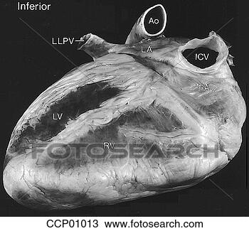 Desenho - cardíaco,  anatomia, 
 externo. fotosearch 
- busca de ilustrações 
clipeart e desenhos