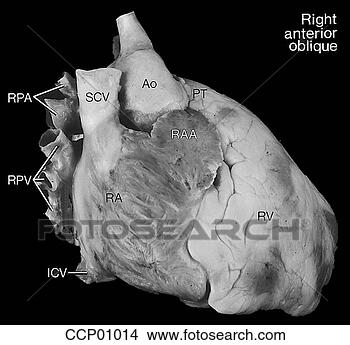 Arquivos de Ilustração - cardíaco,  anatomia, 
 externo. fotosearch 
- busca de ilustrações 
clipeart e desenhos
