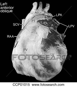 Arquivos de Ilustração - cardíaco,  anatomia, 
 externo. fotosearch 
- busca de ilustrações 
clipeart e desenhos