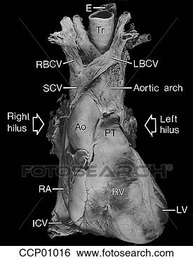 Arquivos de Ilustração - cardíaco,  anatomia, 
 externo. fotosearch 
- busca de ilustrações 
clipeart e desenhos