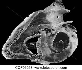 Desenho - cardíaco,  válvulas, 
 atrioventricular. 
fotosearch - busca 
de ilustrações 
clipeart e desenhos