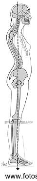 Clipart - postura,  kyphosis-lordosis. 
fotosearch - busca 
de ilustrações 
clipeart e desenhos