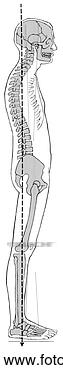 Stock Illustration - posture, sway-back. 
fotosearch - search 
clipart, illustration, 
drawings and vector 
eps graphics images