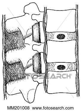 Arquivos de Ilustrações - ligamentos,  espinhal. 
fotosearch - busca 
de ilustrações 
clipeart e desenhos
