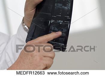 Stock Photo - doctor examining 
an x-ray film. 
fotosearch - search 
stock photos, 
pictures, images, 
and photo clipart