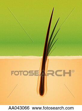 Stock Photo - hair follicle. 
fotosearch - search 
stock photos, 
pictures, images, 
and photo clipart