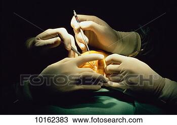 Stock Photo - surgical operation. 
fotosearch - search 
stock photos, 
pictures, images, 
and photo clipart