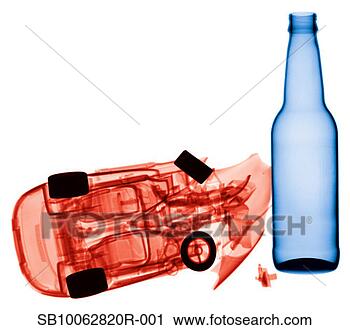 Stock Photography - x-ray image of 
crashed toy car 
and bottle, white 
background. fotosearch 
- search stock 
photos, pictures, 
images, and photo 
clipart