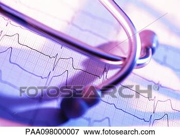 Picture - stethoscope on 
electrocardiogram 
read-out, close-up. 
fotosearch - search 
stock photos, 
pictures, images, 
and photo clipart