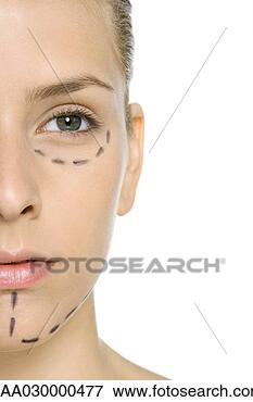 Picture - woman with plastic 
surgery markings 
on face, close-up, 
cropped view. 
fotosearch - search 
stock photos, 
pictures, images, 
and photo clipart