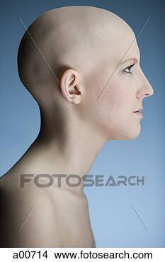 bald-woman_~a00714.jpg