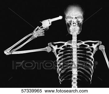 Stock Illustration - x-ray image of 
a person holding 
a pistol to his 
head. fotosearch 
- search clipart, 
illustration, 
drawings and vector 
eps graphics images